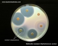 mrsa antibiotic susceptibility test